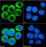 CD40 Chimeric Antibody in Immunocytochemistry (ICC/IF)