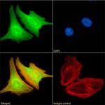 BRD4 Chimeric Recombinant Rabbit Monoclonal Antibody (RAB-C131)
