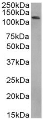 BRD4 Chimeric Antibody in Western Blot (WB)