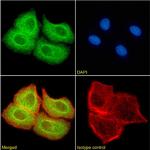 SUV420H2 Chimeric Recombinant Rabbit Monoclonal Antibody (RAB-C409)