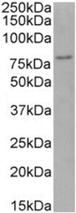 FOXP4 Chimeric Antibody in Western Blot (WB)