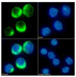 CD25 Chimeric Antibody in Immunocytochemistry (ICC/IF)