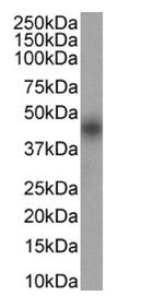 CD25 Chimeric Antibody in Western Blot (WB)