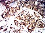 MR1 Antibody in Immunohistochemistry (Paraffin) (IHC (P))