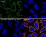 RAB8A Antibody in Immunocytochemistry (ICC/IF)