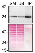 RAB8A Antibody in Immunoprecipitation (IP)
