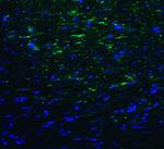 TMIGD2 Antibody in Immunohistochemistry (Paraffin) (IHC (P))