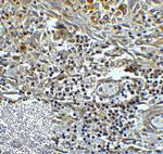 TMIGD2 Antibody in Immunohistochemistry (Paraffin) (IHC (P))