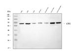 CBS Monoclonal Antibody (7C3B7)