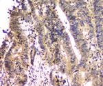 SHP2 Antibody in Immunohistochemistry (Paraffin) (IHC (P))