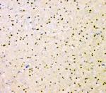 SHP2 Antibody in Immunohistochemistry (Paraffin) (IHC (P))