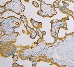 GLUT1 Antibody in Immunohistochemistry (Paraffin) (IHC (P))