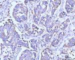 ITCH Antibody in Immunohistochemistry (Paraffin) (IHC (P))
