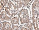 COMT Antibody in Immunohistochemistry (Paraffin) (IHC (P))