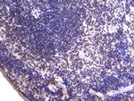 EWSR1 Antibody in Immunohistochemistry (Paraffin) (IHC (P))