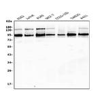 EWSR1 Antibody in Western Blot (WB)