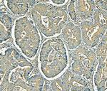 MVP Antibody in Immunohistochemistry (Paraffin) (IHC (P))