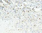 APOBEC3G Antibody in Immunohistochemistry (Paraffin) (IHC (P))