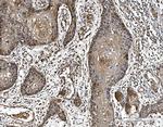 DJ-1 Antibody in Immunohistochemistry (Paraffin) (IHC (P))