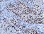 YY1 Antibody in Immunohistochemistry (Paraffin) (IHC (P))
