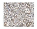 MUT Antibody in Immunohistochemistry (Paraffin) (IHC (P))