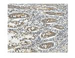 MUT Antibody in Immunohistochemistry (Paraffin) (IHC (P))