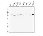 MUT Antibody in Western Blot (WB)