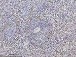 Band 3 Monoclonal Antibody (5G2G7)