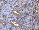 Glutaminase Antibody in Immunohistochemistry (Paraffin) (IHC (P))