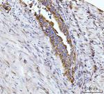 Glutaminase Antibody in Immunohistochemistry (Paraffin) (IHC (P))