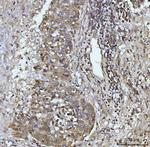 Glutaminase Antibody in Immunohistochemistry (Paraffin) (IHC (P))