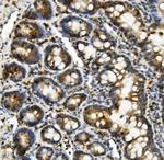 HK1 Antibody in Immunohistochemistry (Paraffin) (IHC (P))