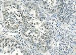 ATF1 Antibody in Immunohistochemistry (Paraffin) (IHC (P))
