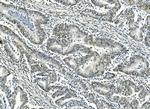ATF1 Antibody in Immunohistochemistry (Paraffin) (IHC (P))