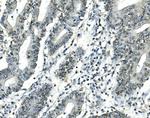 ATF1 Antibody in Immunohistochemistry (Paraffin) (IHC (P))