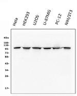 Catenin alpha-1 Antibody in Western Blot (WB)