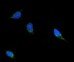 Filamin B Monoclonal Antibody (11E2D2)