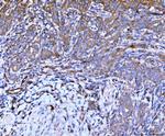 Filamin B Antibody in Immunohistochemistry (Paraffin) (IHC (P))
