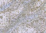 CtBP2 Monoclonal Antibody (7F3E1)