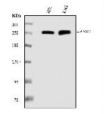 Ankyrin 1 Monoclonal Antibody (5H2E8)