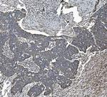 REA Monoclonal Antibody (2B5)