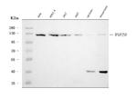 RNF20 Monoclonal Antibody (3C6E2)