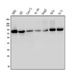 PCQAP Antibody in Western Blot (WB)