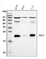 RPL13A Antibody in Western Blot (WB)