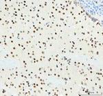 DDX1 Antibody in Immunohistochemistry (Paraffin) (IHC (P))