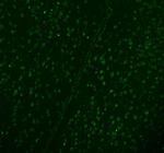 DDX1 Antibody in Immunohistochemistry (Paraffin) (IHC (P))