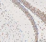 DDX1 Antibody in Immunohistochemistry (Paraffin) (IHC (P))