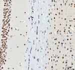 DDX1 Antibody in Immunohistochemistry (Paraffin) (IHC (P))