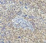 DDX1 Antibody in Immunohistochemistry (Paraffin) (IHC (P))