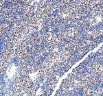 DDX1 Antibody in Immunohistochemistry (Paraffin) (IHC (P))